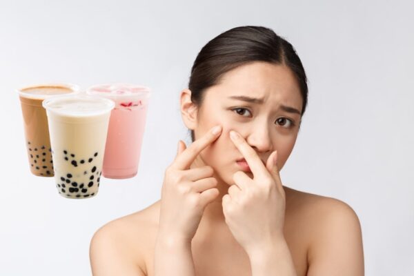 Giải đáp mới nhất về việc uống trà sữa có nổi mụn không